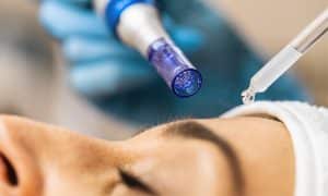 microneedling med näsa och ansikte i fokus