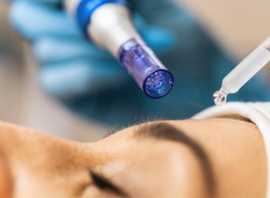 microneedling med näsa och ansikte i fokus
