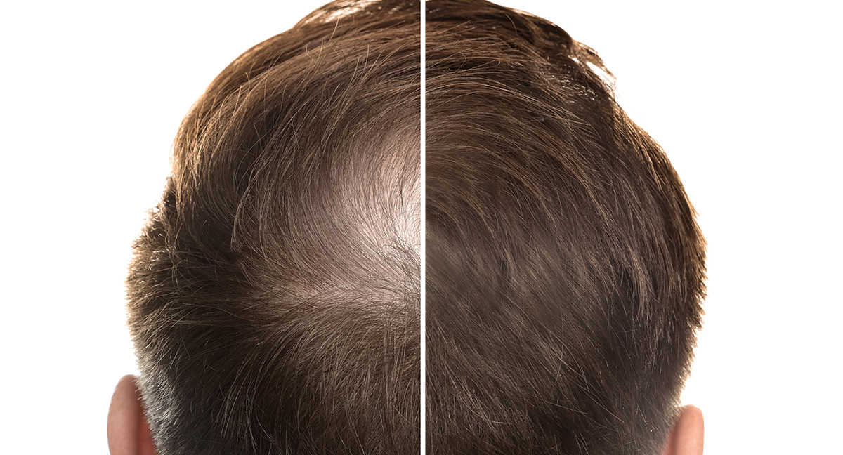 Before and after image example – Hair